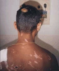 Man beaten